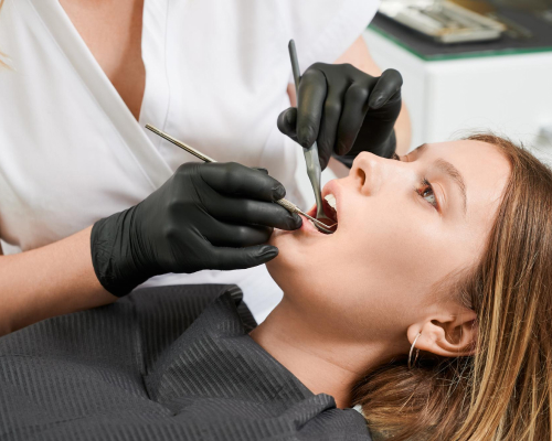 dental sealants folsom ca