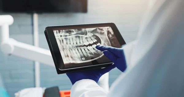 digital radiography in folsom