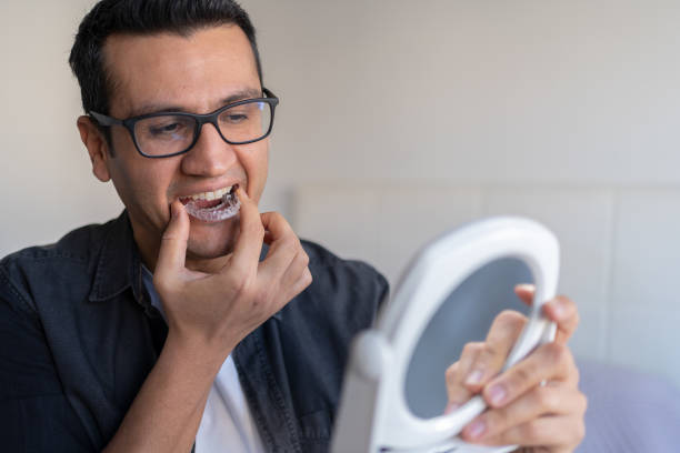 man applying a transparent dental aligner