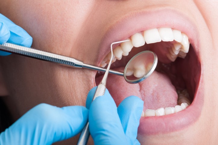 a cavity from birth to damage