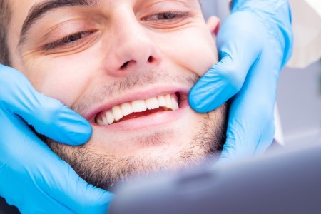 tartar is the root of many dental evils
